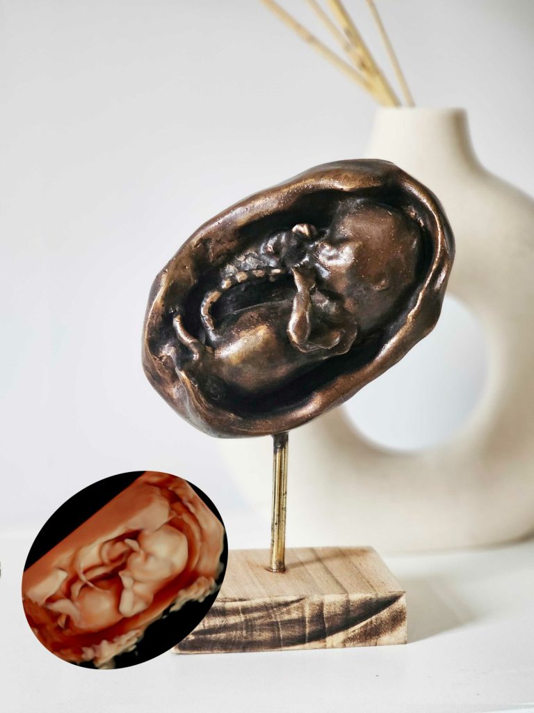 3D Echobeeld in brons gemaakt van een echo