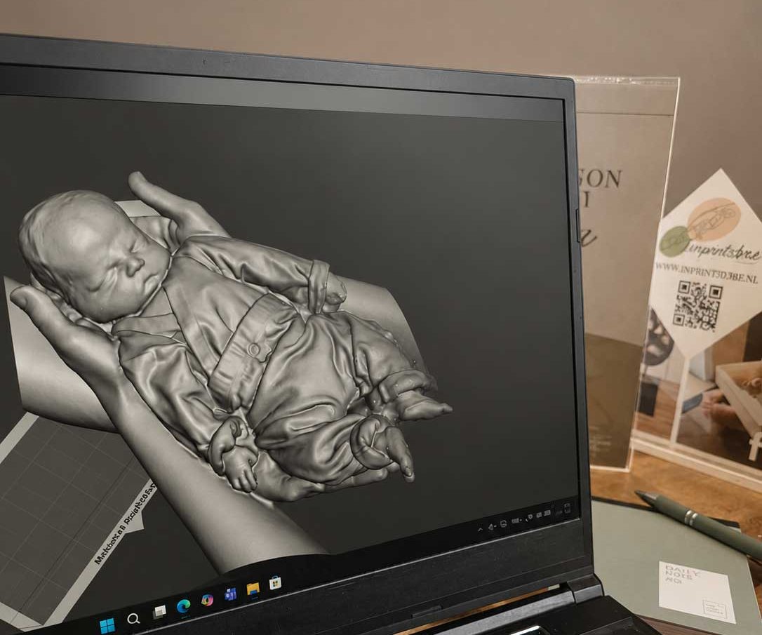 Overleden kindje ingescand met 3D scan